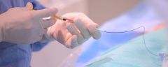 Intra arterial chemotherapy